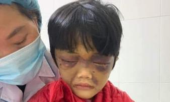 Điều tra vụ bé gái 6 tuổi bị mẹ đẻ đánh tới nhập viện ở Hải Dương Điều tra vụ bé gái 6 tuổi bị mẹ đẻ đánh tới nhập viện ở Hải Dương