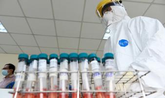 Trưa 18/6: Có thêm 121 ca mắc COVID-19, riêng TP Hồ Chí Minh có 59 ca mới Trưa 18/6: Có thêm 121 ca mắc COVID-19, riêng TP Hồ Chí Minh có 59 ca mới