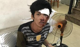 TP.HCM: Đẩy bạn xuống kênh để cướp tài sản, gã thanh niên tông vào con lươn bất tỉnh TP.HCM: Đẩy bạn xuống kênh để cướp tài sản, gã thanh niên tông vào con lươn bất tỉnh