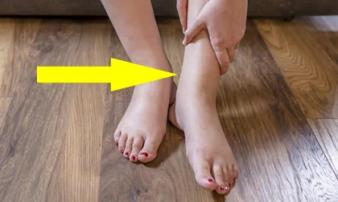 3 bất thường ở đôi chân báo hiệu tử cung đang rất xấu, thậm chí mang bệnh nặng 3 bất thường ở đôi chân báo hiệu tử cung đang rất xấu, thậm chí mang bệnh nặng