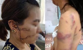 Những vụ bạo lực gia đình ám ảnh kinh hoàng: Người bị cắt gân chân, người bị lột đồ đánh đập dã man trước mặt con nhỏ Những vụ bạo lực gia đình ám ảnh kinh hoàng: Người bị cắt gân chân, người bị lột đồ đánh đập dã man trước mặt con nhỏ