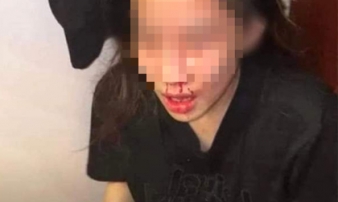 Quảng Ninh: Chồng đánh vợ đang mang bầu rồi phát trực tiếp trên Facebook