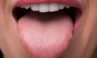 Lưỡi là 'thước đo' sức khỏe: Nếu 4 thay đổi này không xuất hiện thì chứng tỏ sức khỏe bạn đang rất ổn định Lưỡi là 'thước đo' sức khỏe: Nếu 4 thay đổi này không xuất hiện thì chứng tỏ sức khỏe bạn đang rất ổn định