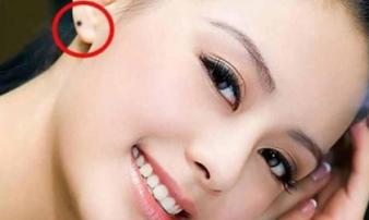 Thầy tướng số nói: Người có nốt ruồi ở đây, định mệnh giàu sang, tiền vào như nước, muốn nghèo cũng không nổi