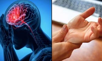 Dấu hiệu cảnh báo đột quỵ trước một tuần tuyệt đối đừng bỏ qua Dấu hiệu cảnh báo đột quỵ trước một tuần tuyệt đối đừng bỏ qua