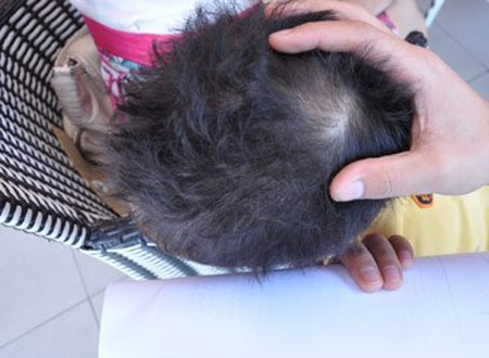 Theo gia đình, bé T.S mấy ngày qua nhất quyết không muốn đến trường vì “sợ bị cô giáo đánh”.