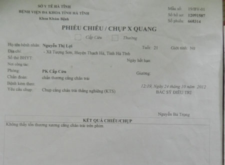 Kết quả chụp X.quang của BVĐK Hà Tĩnh