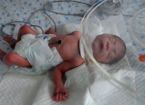 Em bé được tìm thấy trong một bọc nilon ở thùng rác ở thành phố An Sơn, Trung Quốc