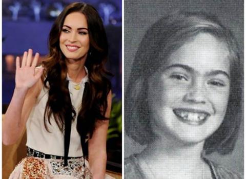 Người đẹp kể cả khi răng sún cũng vẫn toát lên nét xinh đẹp, dễ thương.