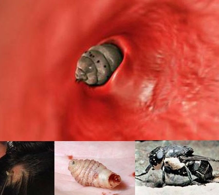 Những ấu trùng có hại trong cơ thể (Ảnh minh họa)