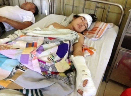 Hung thủ Nguyễn Vũ Sang đang cấp cứu tại bệnh viện