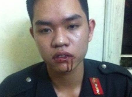 Chiến sĩ cảnh sát cơ động bị nữ sinh đánh thô bạo