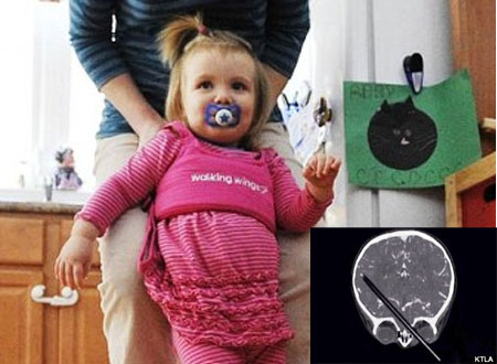 Bé Olivia Smith may mắn thoát chết sau tai nạn kinh hoàng.