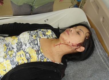 Bà Giám đốc bị trọng thương.