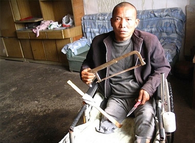 Zheng Yanliang, 47 tuổi, tự cưa chân mình bằng những dụng cụ thô sơ