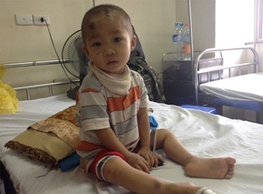 Bé Đỗ Việt Anh tại bệnh viện