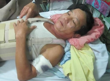 Ông Dương Xuân Hoàng đang điều trị tại Bệnh viện 115 Nghệ An