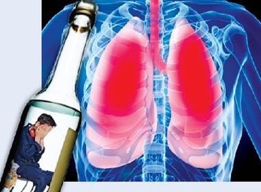 Viêm phổi lại là một nguy cơ gây tử vong hàng đầu  ở người nghiện rượu