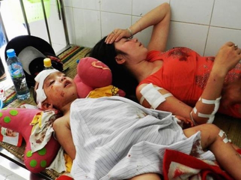 Cháu Lê Đức Thiện (4 tuổi) bị tai nạn ngày 19/2 khi đang điều trị tại BVĐK Tri Tôn (An Giang)