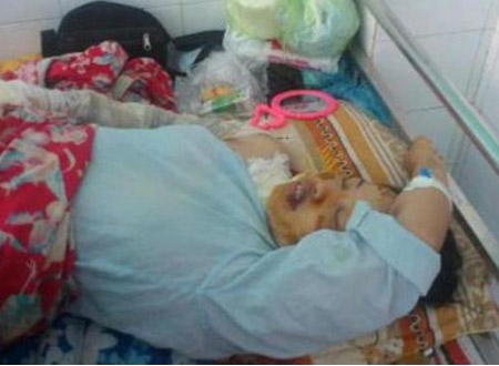 Chị Hiếu hiện đã qua cơn nguy kịch và đang được điều trị tại bệnh viện tỉnh Thái Bình