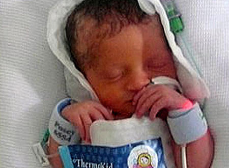 Cô bé sống sót kỳ diệu sau khi được đặt vào chiếc túi làm lạnh.