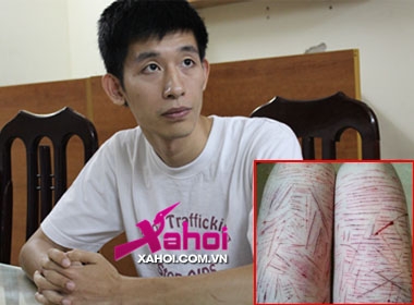Kẻ tung tin rạch đùi gây hoang mang  là Nguyễn Khánh Thành tại cơ quan điều tra