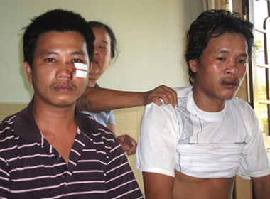 Hai anh Nguyễn Kim Đệ (trái) và Nguyễn Ngọc Phương trình bày lại sự việc khi trên mặt còn đầy thương tích. Ảnh: TẤN LỘC