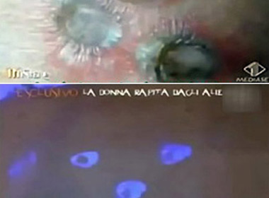 Những vết sẹo kỳ lạ trên người Giovnana kể từ khi bị người ngoài hành tinh 