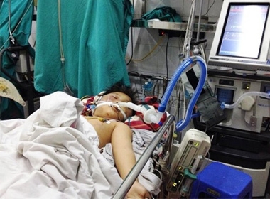 Bé Lộc đang được cấp cứu tại Bệnh viện Việt Đức trong tình trạng hôn mê sâu, nguy cơ tử vong cao