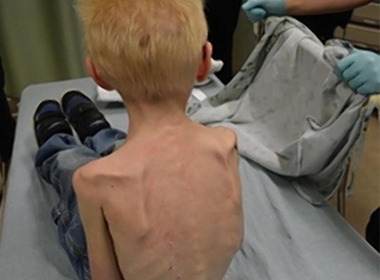 Cậu bé 5 tuổi bị nhốt trong tủ quần áo và chỉ còn da bọc xương.