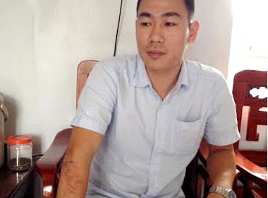 Anh Nguyễn Duy Long kể lại sự việc bị trưởng thôn và nhóm thanh niên 'truy sát'