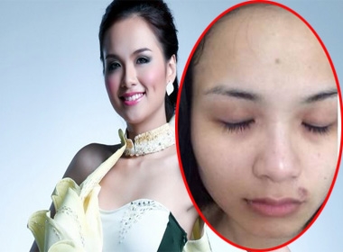 Hoa hậu Diễm Hương bị chồng hành hung về thể xác lẫn tinh thần