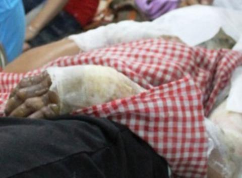 Hai mẹ con bị tạt xăng đốt trong đêm ở Đồng Nai