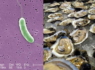 Cảnh báo tử vong do vi khuẩn ăn thịt người tắm biển