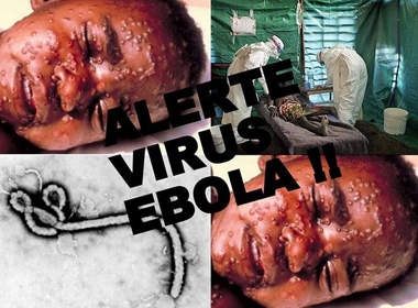 Dấu hiệu nhận biết người nhiễm Ebola trong thời gian ủ bệnh