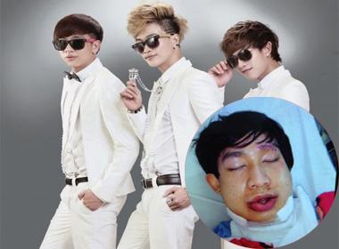 Sốc với gương mặt bị chấn thương nghiêm trọng của thành viên HKT