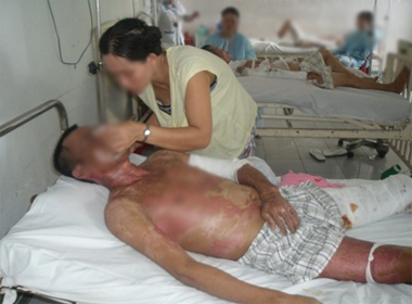 Con gái vào bệnh viện chăm sóc người cha bị bỏng (Ảnh minh hoạ)