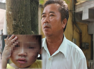 Bé 2 tuổi bị đánh dã man: Ông nội kể lại khoảnh khắc đáng sợ khi cháu ngất xỉu