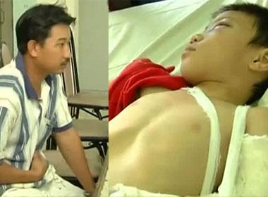 Quá khứ không ngờ của cha dượng đánh con trai 6 tuổi 