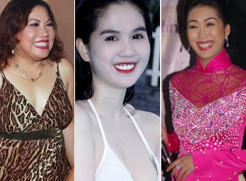 'Nhăn mặt' trước những nụ cười hở lợi của mỹ nhân Việt