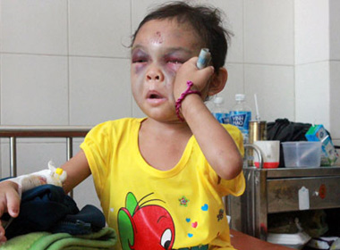 Bạo hành dã man trẻ em: Cần truy tố về tội Giết người?