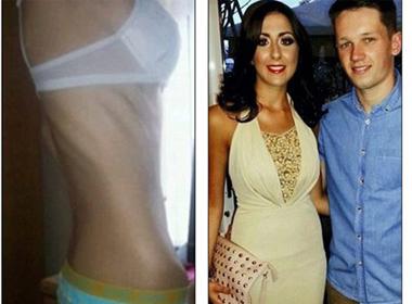 Cô Rebekah thời 23 kg và hiện tại