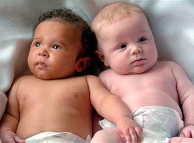 Cặp song sinh cùng mẹ khác cha ở Trung Quốc
