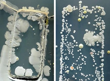 Hình ảnh đáng sợ về các vi khuẩn 'vô hình' trên di động