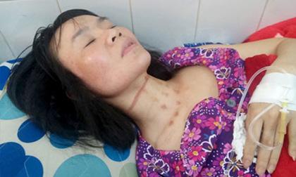 Khi em nuôi lộ mặt kẻ cướp 