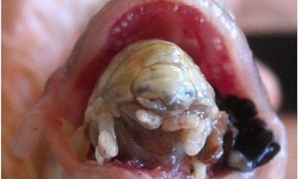Nhìn tận mắt các loài ký sinh trùng ăn lưỡi, não, mắt người 