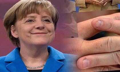 Móng tay bà Merkel gây “bão” mạng