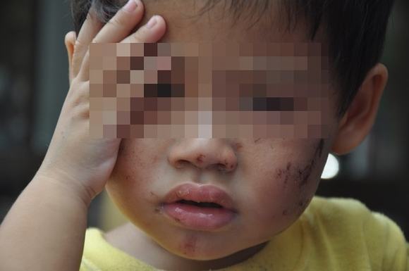 Nhờ hàng xóm trông giùm em bé 2 tuổi bị đánh gẫy răng và hôn mê, Sài Gòn List