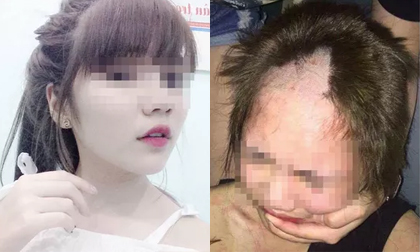 Cô gái 17 tuổi bị cạo đầu đánh ghen do 'quan hệ nhầm'