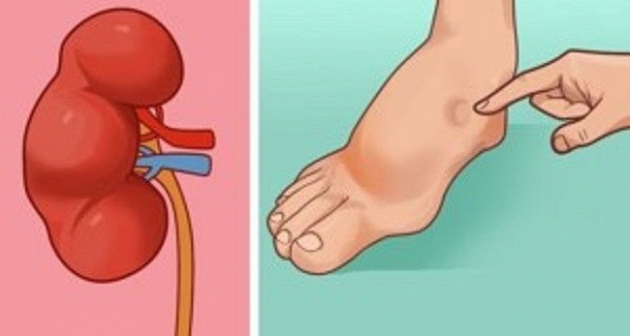 dấu hiệu cảnh báo đột quỵ 0